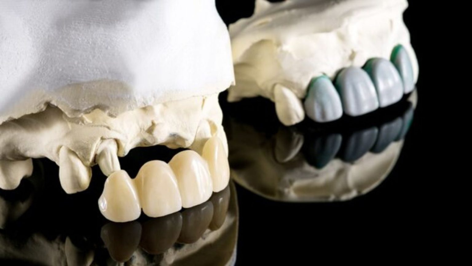 Denture Stain Removal Restore Your Smile's Brilliance Today!