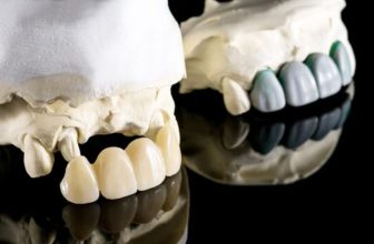 Clean Black Stains on Dentures