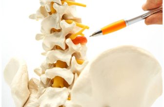 Prevent a Hernia from Getting Worse