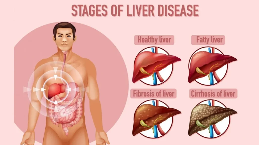 How to Flush Medication from Your Body