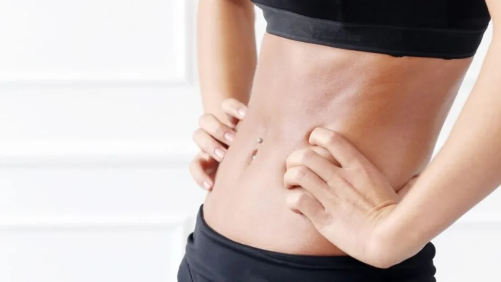 How to Tighten Stomach Skin After Weight Loss