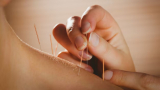 How to Know Acupuncture is Working: Signs of Healing