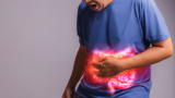How to Address Ulcerative Colitis in 90 Days: An In-Depth Guide