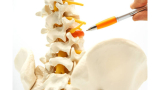 How to Prevent a Hernia from Getting Worse: Guarding Your Well-Being