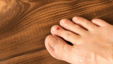 How to Treat Pinky Toe Blisters: Treating Pinky Toe Blisters Effectively